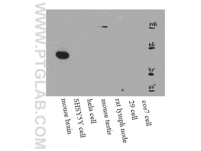 Western Blot (WB) analysis of mouse brain tissue using RGS14 Polyclonal antibody (16258-1-AP)