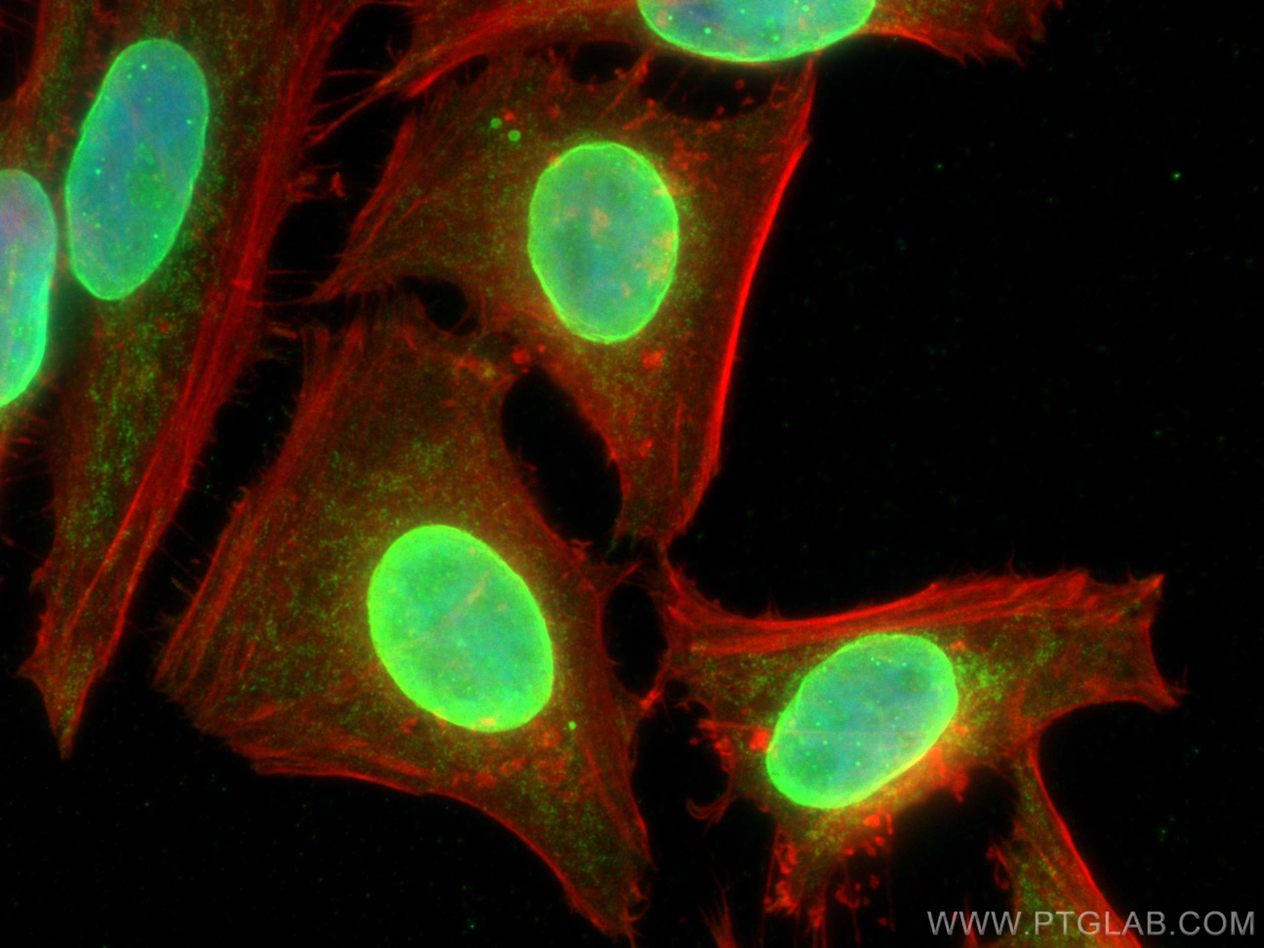 Immunofluorescence (IF) / fluorescent staining of HeLa cells using RGS14 Monoclonal antibody (67394-1-Ig)