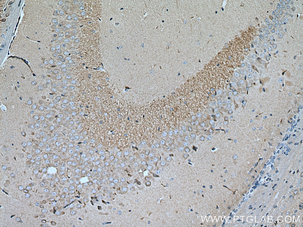 Immunohistochemistry (IHC) staining of mouse brain tissue using RGS14 Monoclonal antibody (67394-1-Ig)