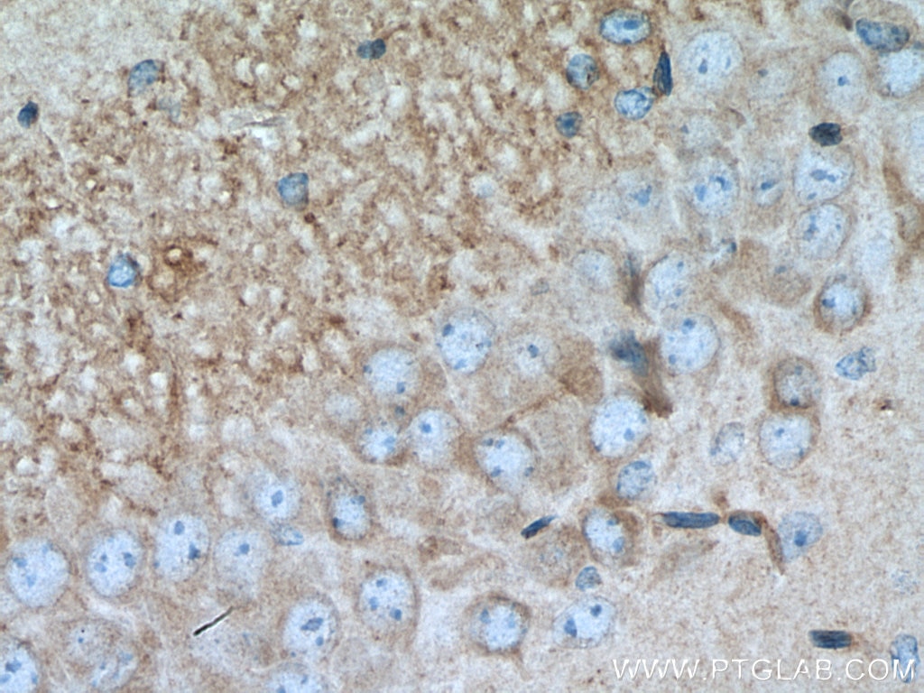 Immunohistochemistry (IHC) staining of mouse brain tissue using RGS14 Monoclonal antibody (67394-1-Ig)