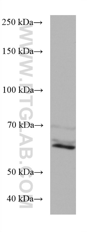 Western Blot (WB) analysis of HeLa cells using RGS14 Monoclonal antibody (67394-1-Ig)