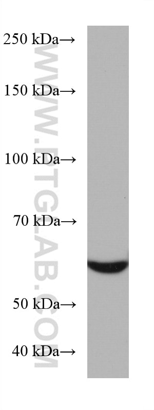 Western Blot (WB) analysis of Jurkat cells using RGS14 Monoclonal antibody (67394-1-Ig)