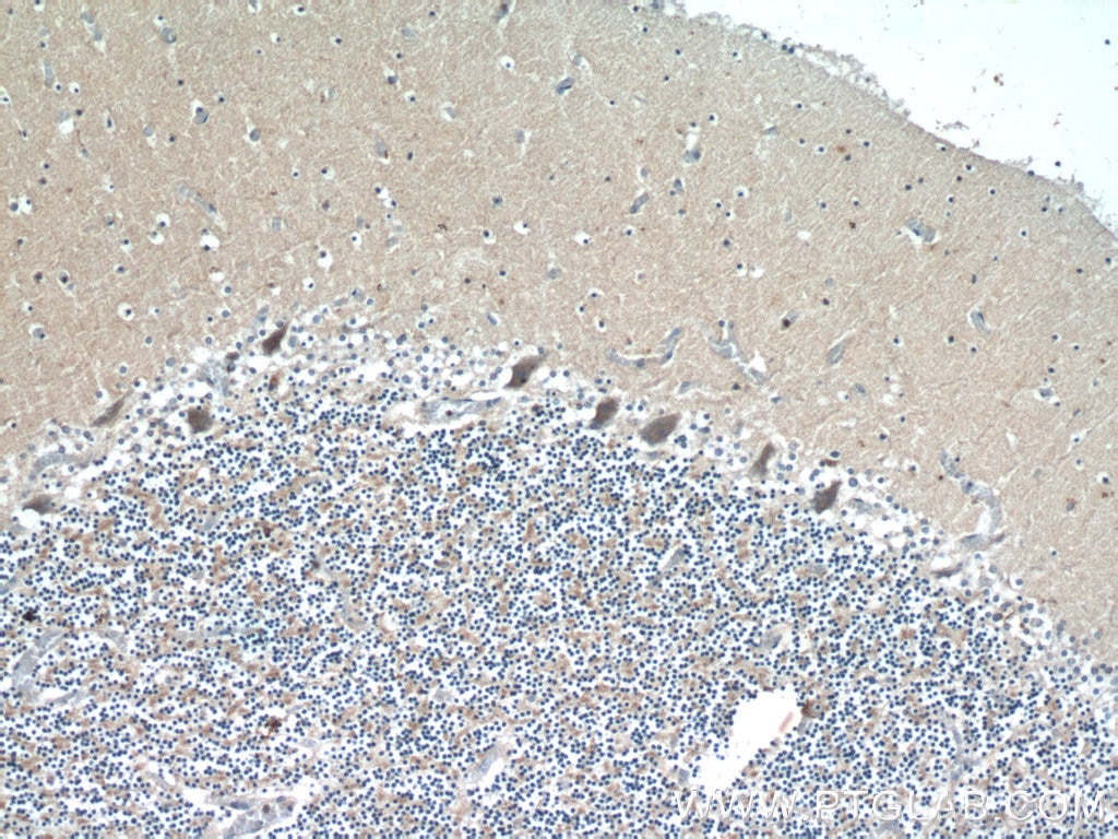 IHC staining of human cerebellum using 12549-1-AP