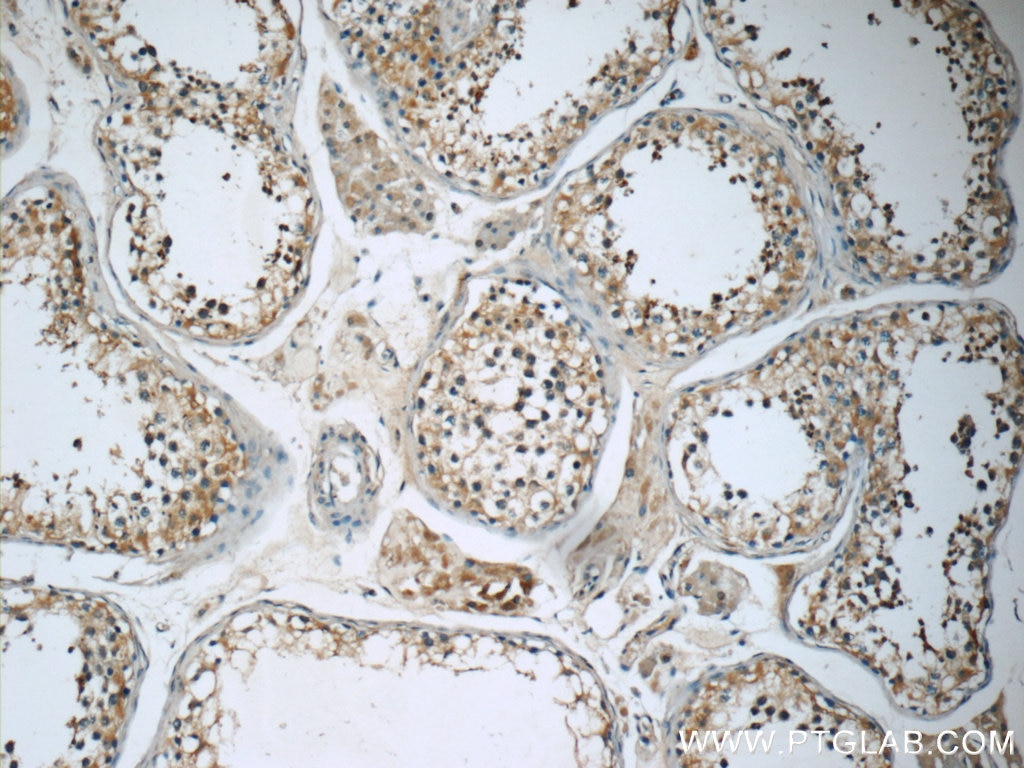 Immunohistochemistry (IHC) staining of human testis tissue using RGS17 Polyclonal antibody (12549-1-AP)