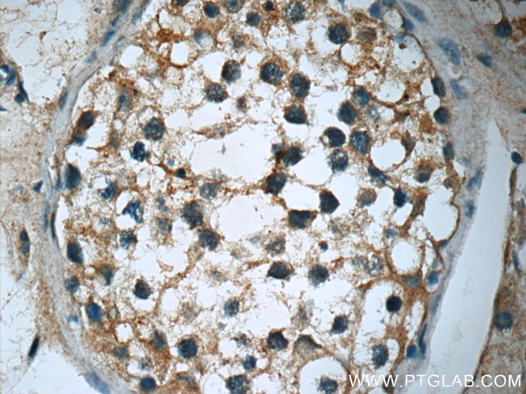 Immunohistochemistry (IHC) staining of human testis tissue using RGS17 Polyclonal antibody (12549-1-AP)