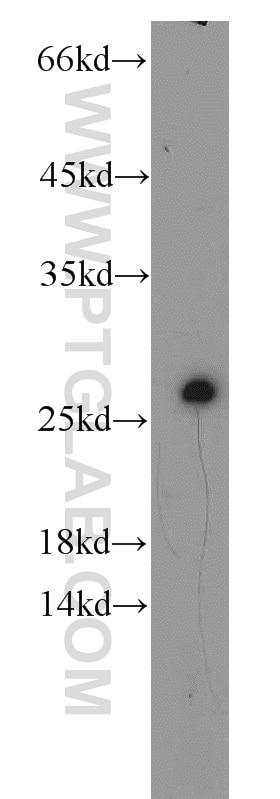 Western Blot (WB) analysis of SH-SY5Y cells using RGS17 Polyclonal antibody (12549-1-AP)