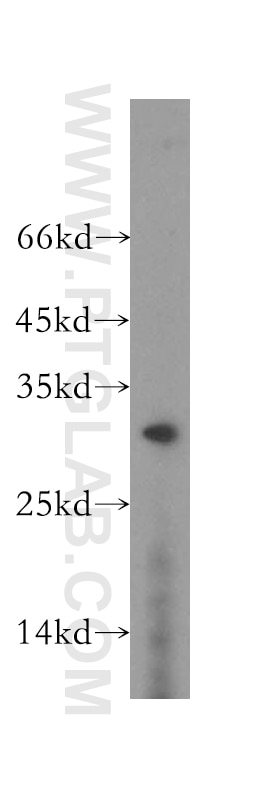 Western Blot (WB) analysis of MCF-7 cells using RGS17 Polyclonal antibody (12549-1-AP)