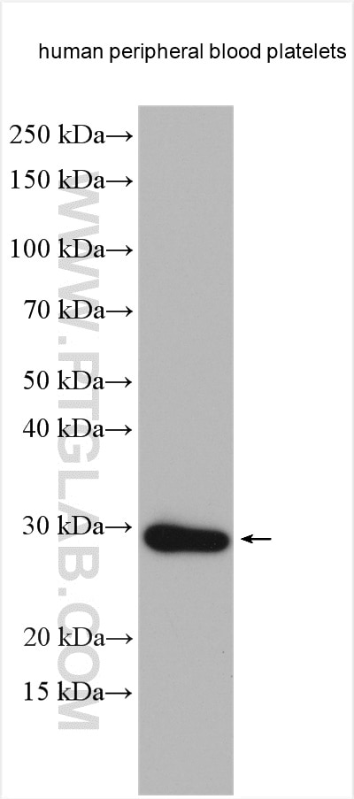 Western Blot (WB) analysis of various lysates using RGS18 Polyclonal antibody (11866-1-AP)
