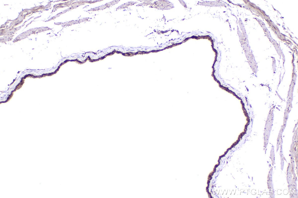 Immunohistochemistry (IHC) staining of mouse bladder tissue using RGS2 Polyclonal antibody (10678-1-AP)