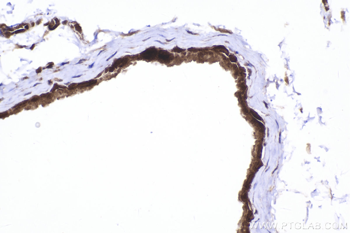 Immunohistochemistry (IHC) staining of mouse bladder tissue using RGS2 Polyclonal antibody (10678-1-AP)