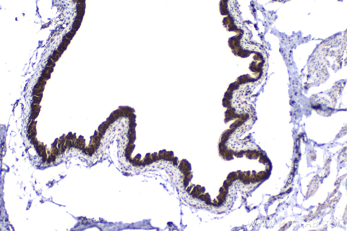 Immunohistochemistry (IHC) staining of rat bladder tissue using RGS2 Polyclonal antibody (10678-1-AP)
