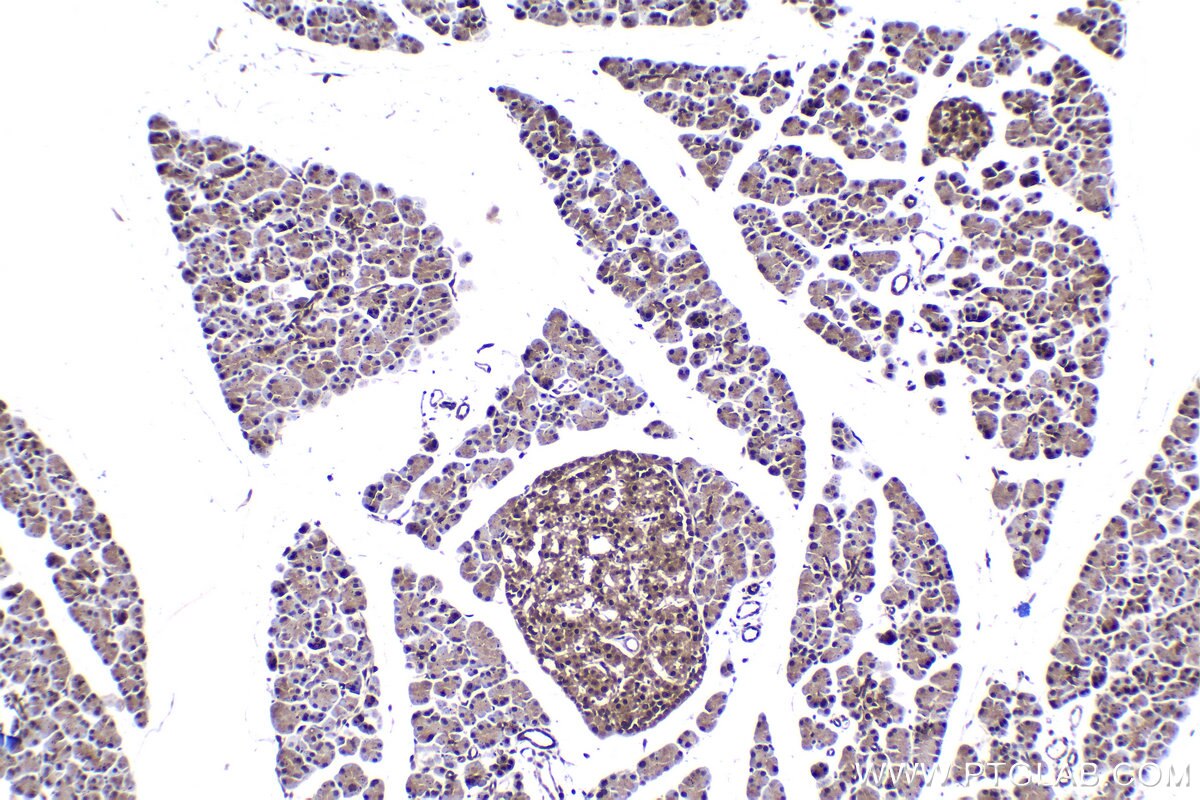 Immunohistochemistry (IHC) staining of rat pancreas tissue using RGS2 Polyclonal antibody (10678-1-AP)