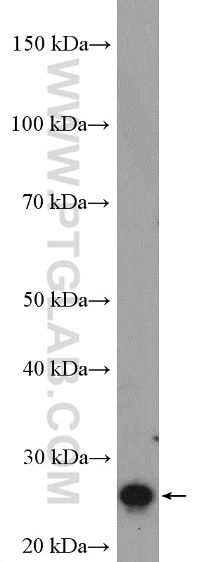 Western Blot (WB) analysis of fetal human brain tissue using RGS2 Polyclonal antibody (10678-1-AP)