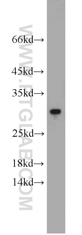 Western Blot (WB) analysis of human brain tissue using RGS2 Polyclonal antibody (10678-1-AP)