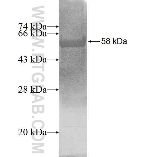 RGS20 fusion protein Ag1760 SDS-PAGE