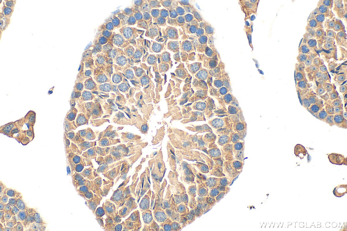 Immunohistochemistry (IHC) staining of mouse testis tissue using RGS22 Polyclonal antibody (28231-1-AP)