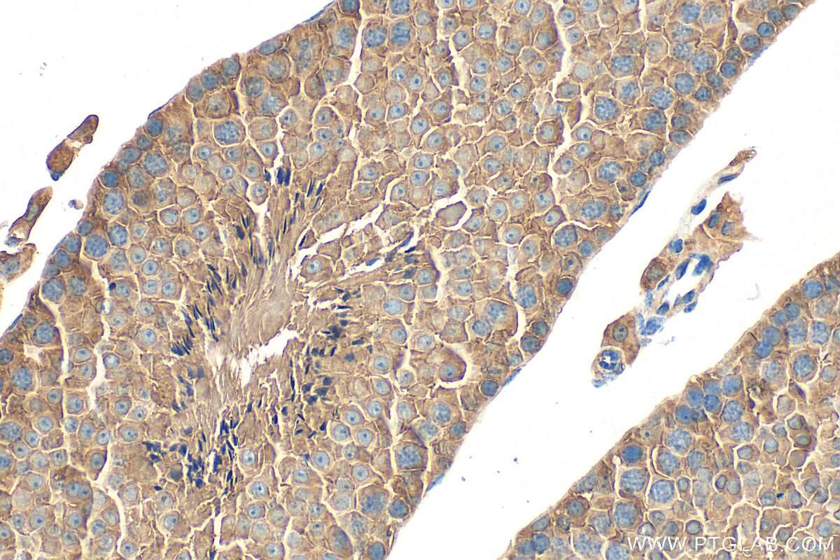 Immunohistochemistry (IHC) staining of mouse testis tissue using RGS22 Polyclonal antibody (28231-1-AP)