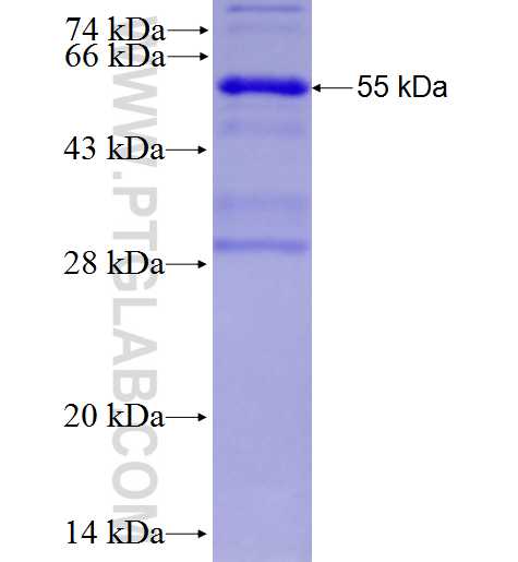 RGS22 fusion protein Ag28156 SDS-PAGE