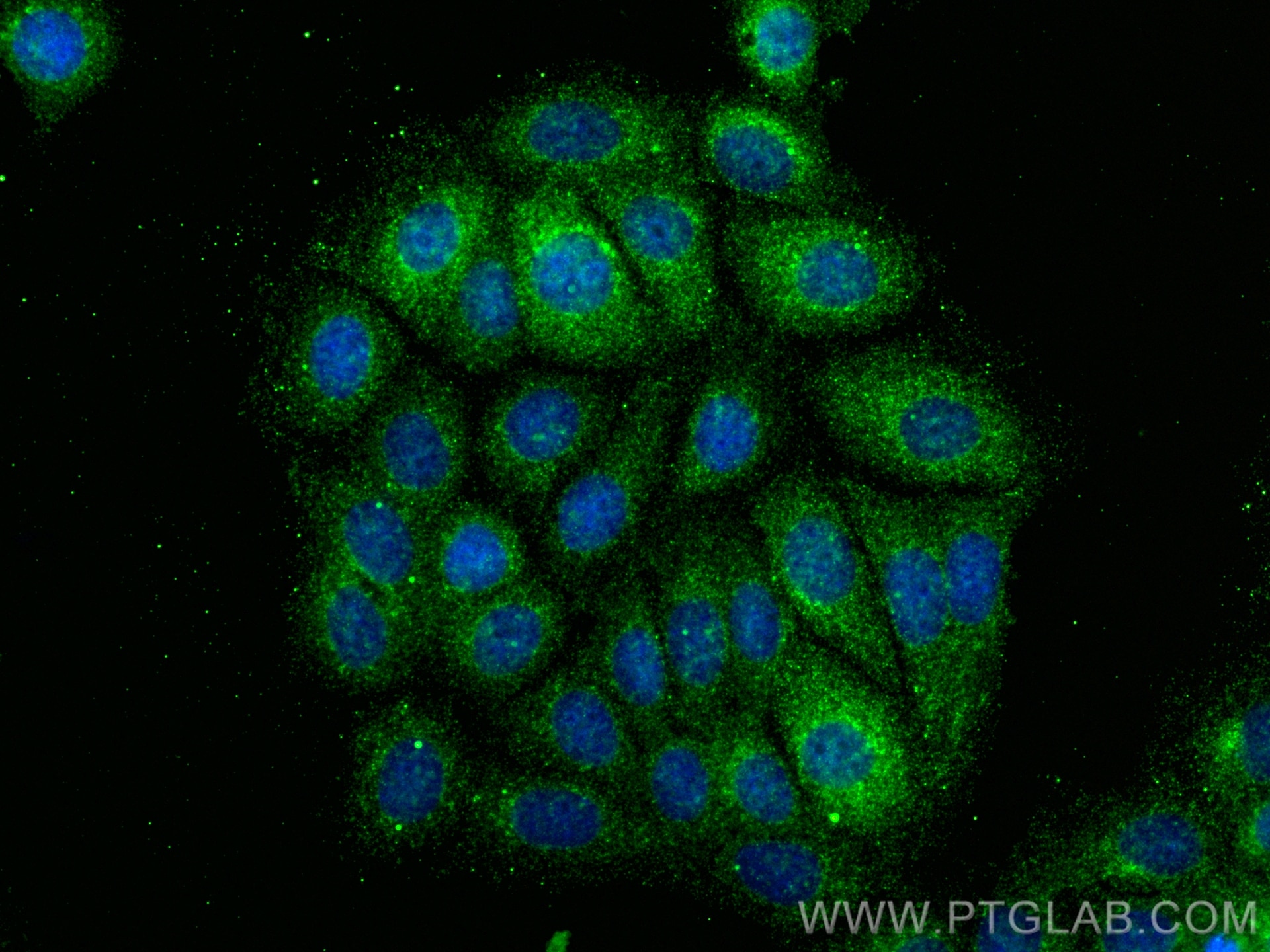 Immunofluorescence (IF) / fluorescent staining of MCF-7 cells using RGS3 Monoclonal antibody (66790-1-Ig)