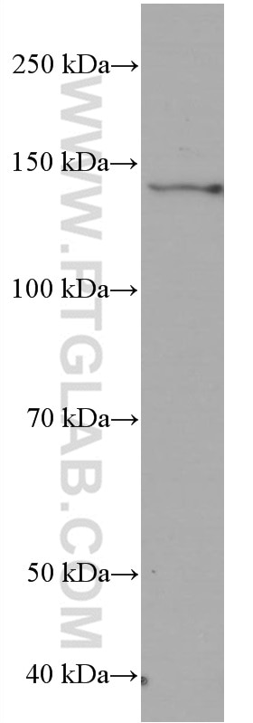 Western Blot (WB) analysis of HEK-293 cells using RGS3 Monoclonal antibody (66790-1-Ig)