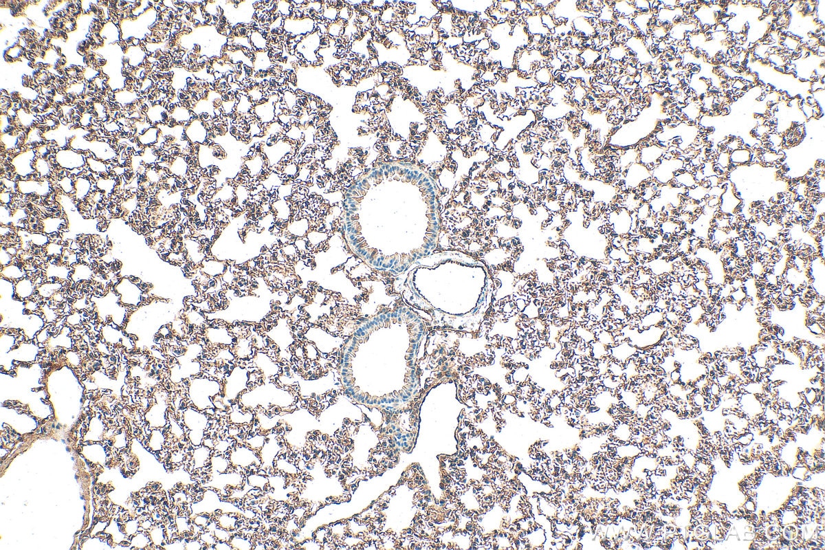 Immunohistochemical analysis of paraffin-embedded mouse lung tissue slide using 14530-1-AP (RGS4 antibody) at dilution of 1:200 (under 10x lens). Heat mediated antigen retrieval with Tris-EDTA buffer (pH 9.0). Immunohistochemistry (IHC) staining of mouse lung tissue using RGS4 Polyclonal antibody (14530-1-AP)