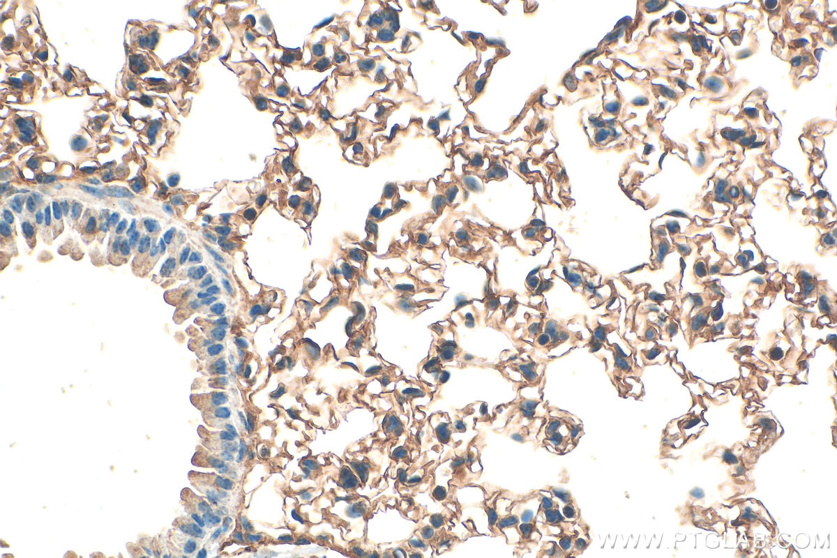 Immunohistochemical analysis of paraffin-embedded mouse lung tissue slide using 14530-1-AP (RGS4 antibody) at dilution of 1:200 (under 40x lens). Heat mediated antigen retrieval with Tris-EDTA buffer (pH 9.0). Immunohistochemistry (IHC) staining of mouse lung tissue using RGS4 Polyclonal antibody (14530-1-AP)