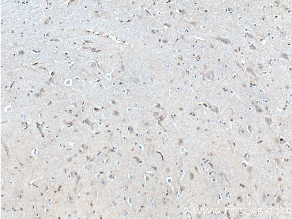 Immunohistochemistry (IHC) staining of human brain tissue using RGS4 Polyclonal antibody (14530-1-AP)