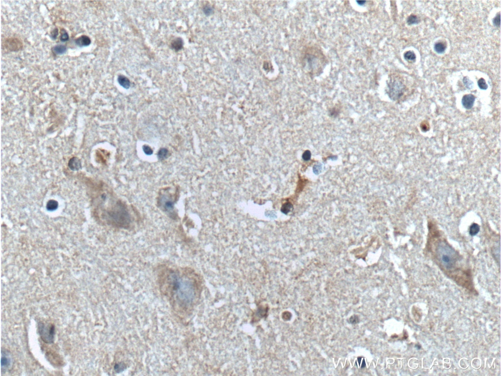 Immunohistochemistry (IHC) staining of human brain tissue using RGS4 Polyclonal antibody (14530-1-AP)