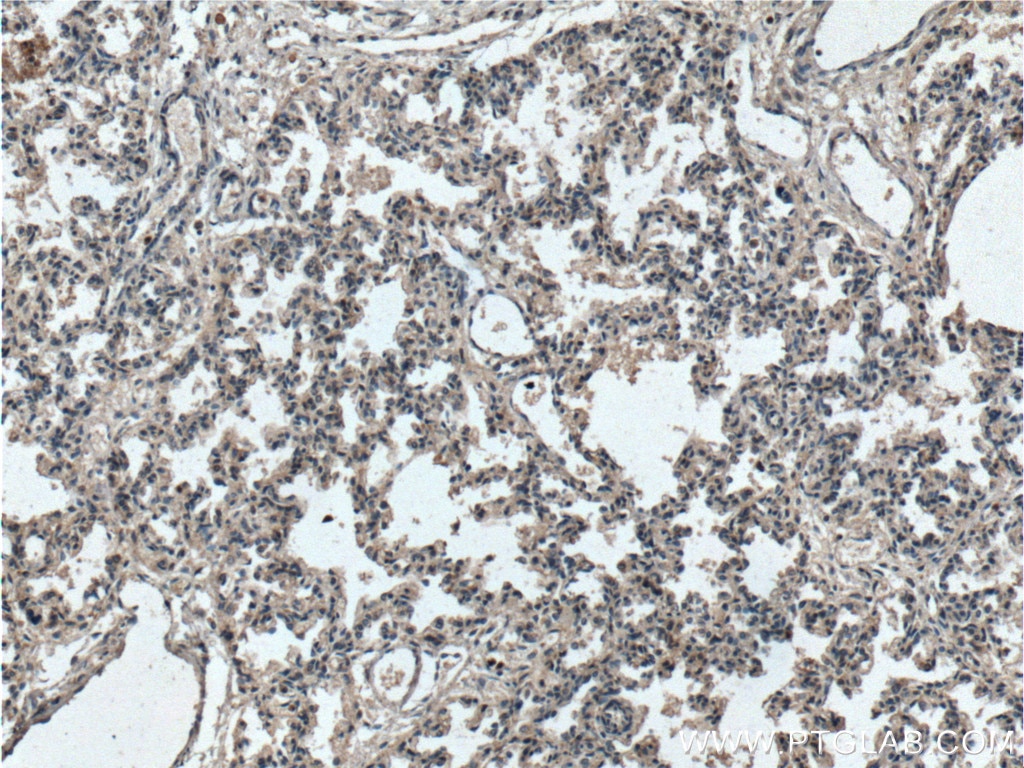 Immunohistochemistry (IHC) staining of human lung tissue using RGS4 Polyclonal antibody (14530-1-AP)