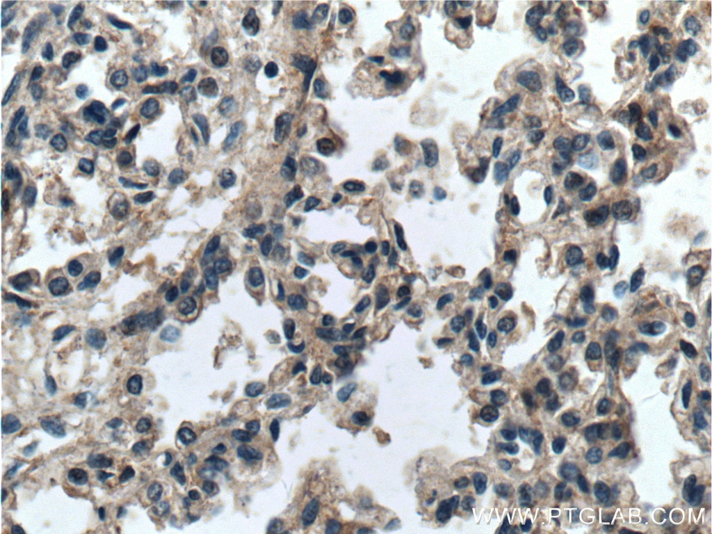 IHC staining of human lung using 14530-1-AP