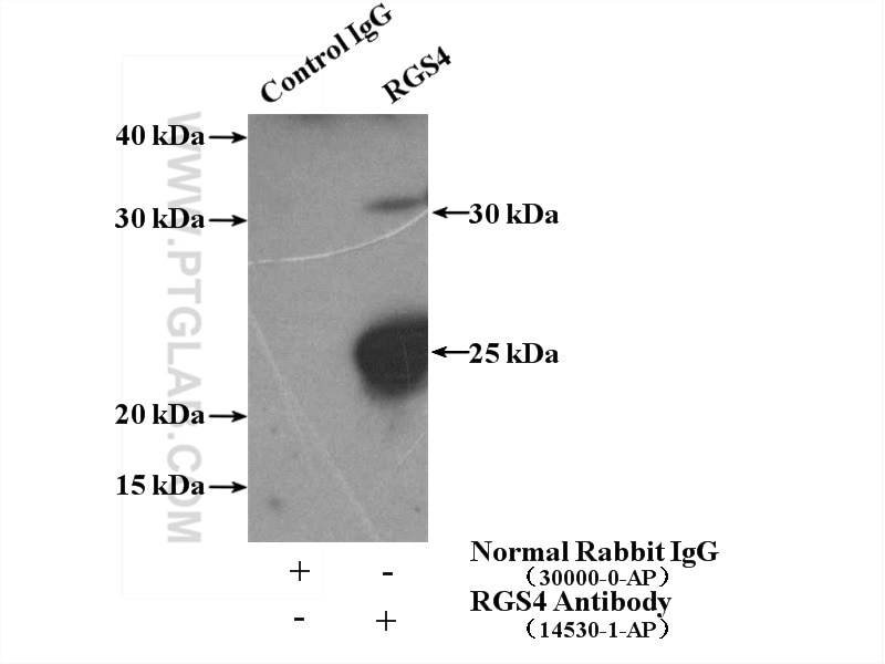 Immunoprecipitation (IP) experiment of mouse brain tissue using RGS4 Polyclonal antibody (14530-1-AP)