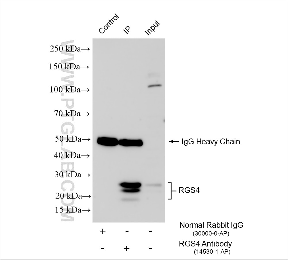 Immunoprecipitation (IP) experiment of SH-SY5Y cells using RGS4 Polyclonal antibody (14530-1-AP)