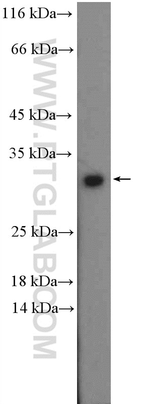 Western Blot (WB) analysis of mouse brain tissue using RGS4 Polyclonal antibody (14530-1-AP)