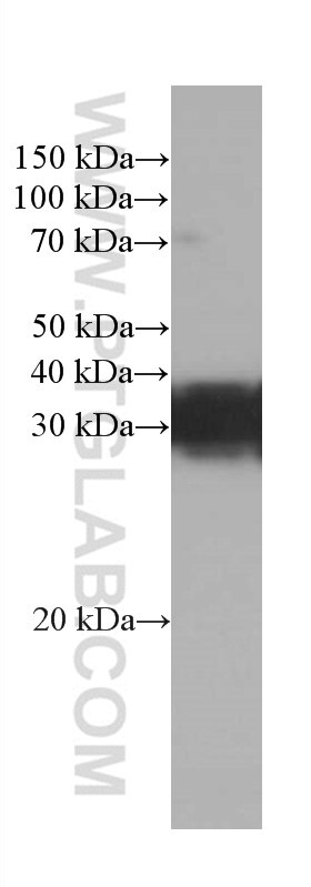 Western Blot (WB) analysis of Neuro-2a cells using RGS4 Monoclonal antibody (66441-1-Ig)