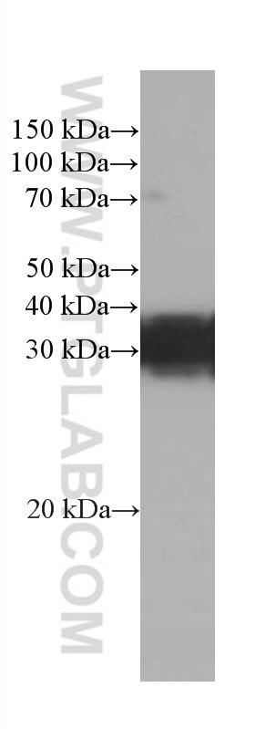 WB analysis of Neuro-2a using 66441-1-Ig