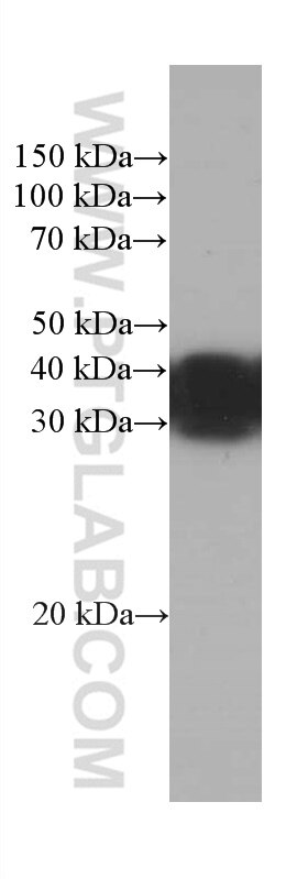 WB analysis of C6 using 66441-1-Ig