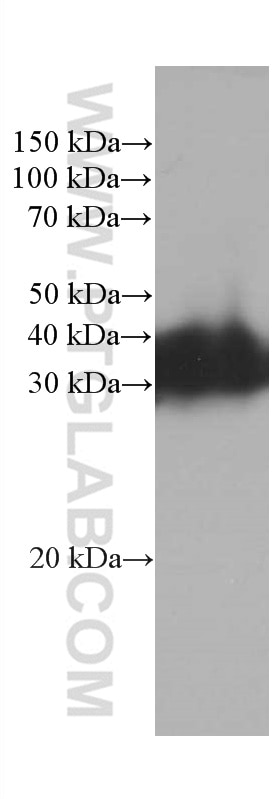 Western Blot (WB) analysis of Y79 cells using RGS4 Monoclonal antibody (66441-1-Ig)