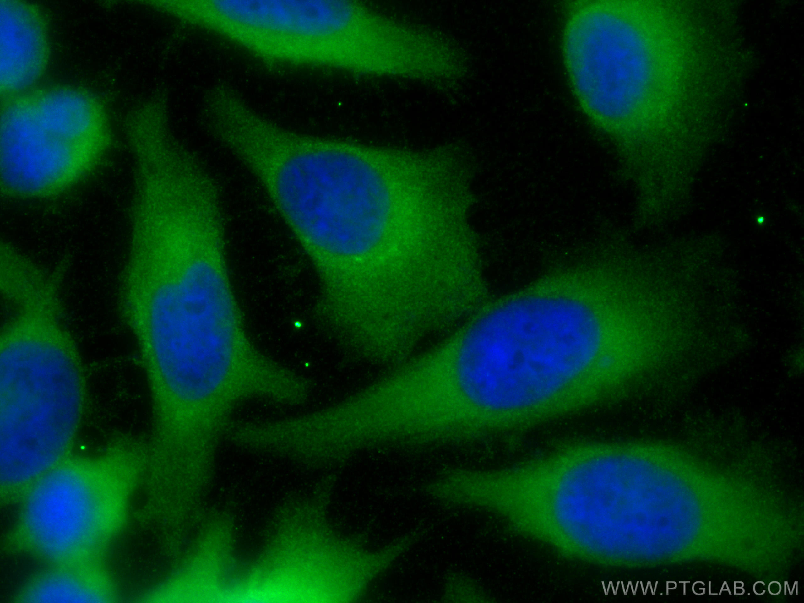 Immunofluorescence (IF) / fluorescent staining of HeLa cells using RGS5 Polyclonal antibody (11590-1-AP)