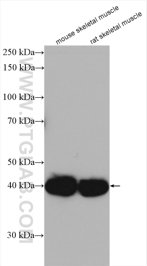 Western Blot (WB) analysis of various lysates using RGS5 Polyclonal antibody (11590-1-AP)