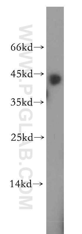 Western Blot (WB) analysis of mouse skeletal muscle tissue using RGS5 Polyclonal antibody (11590-1-AP)