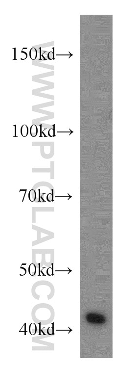 Western Blot (WB) analysis of human skeletal muscle tissue using RGS5 Polyclonal antibody (11590-1-AP)