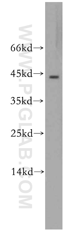 Western Blot (WB) analysis of mouse heart tissue using RGS5 Polyclonal antibody (11590-1-AP)