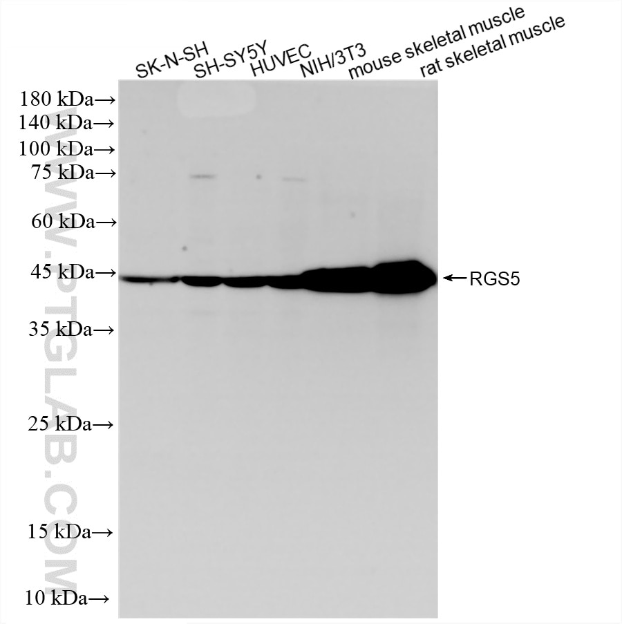 WB analysis using 88404-1-RR Western Blot (WB) analysis of various lysates using RGS5 Recombinant monoclonal antibody (88404-1-RR)