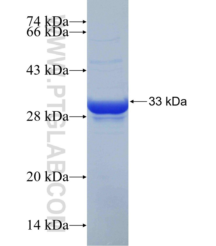 RGS5 fusion protein Ag30455 SDS-PAGE