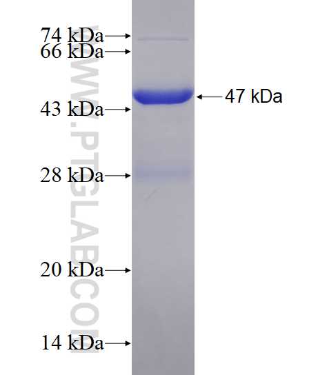 RGS5 fusion protein Ag2196 SDS-PAGE