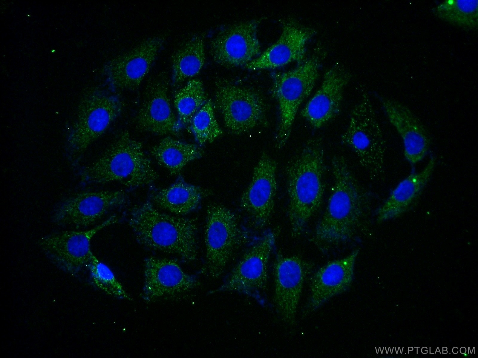 IF Staining of SH-SY5Y using 14056-1-AP