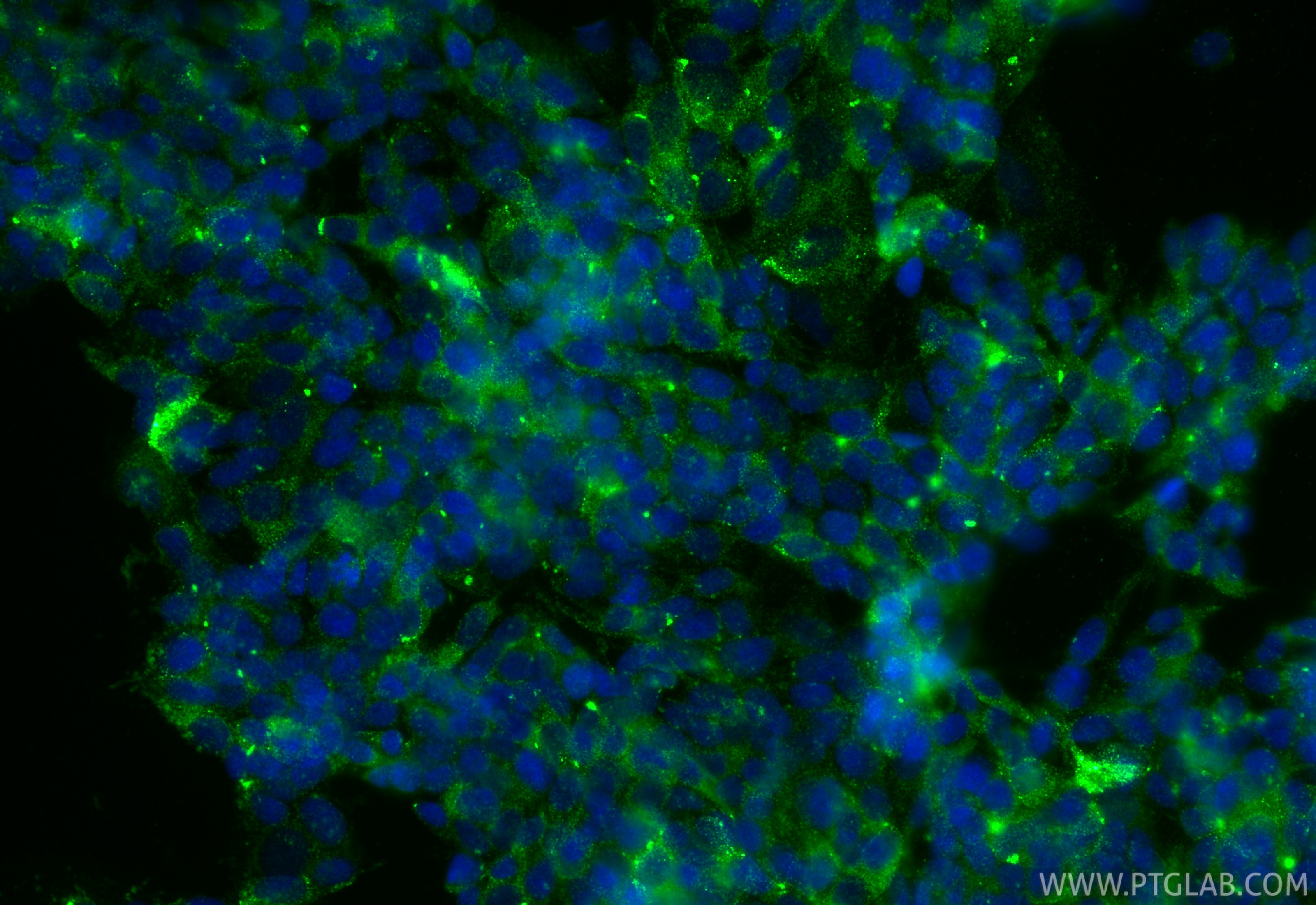 Immunofluorescence (IF) / fluorescent staining of SH-SY5Y cells using RGS7 Polyclonal antibody (14056-1-AP)