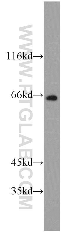 Western Blot (WB) analysis of SH-SY5Y cells using RGS7 Polyclonal antibody (14056-1-AP)