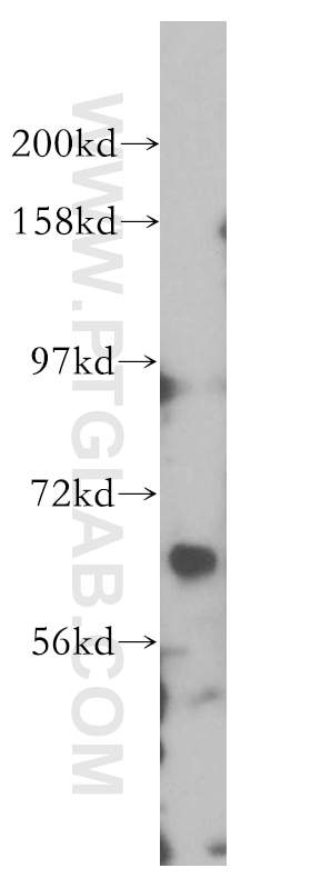 Western Blot (WB) analysis of SH-SY5Y cells using RGS7 Polyclonal antibody (14056-1-AP)