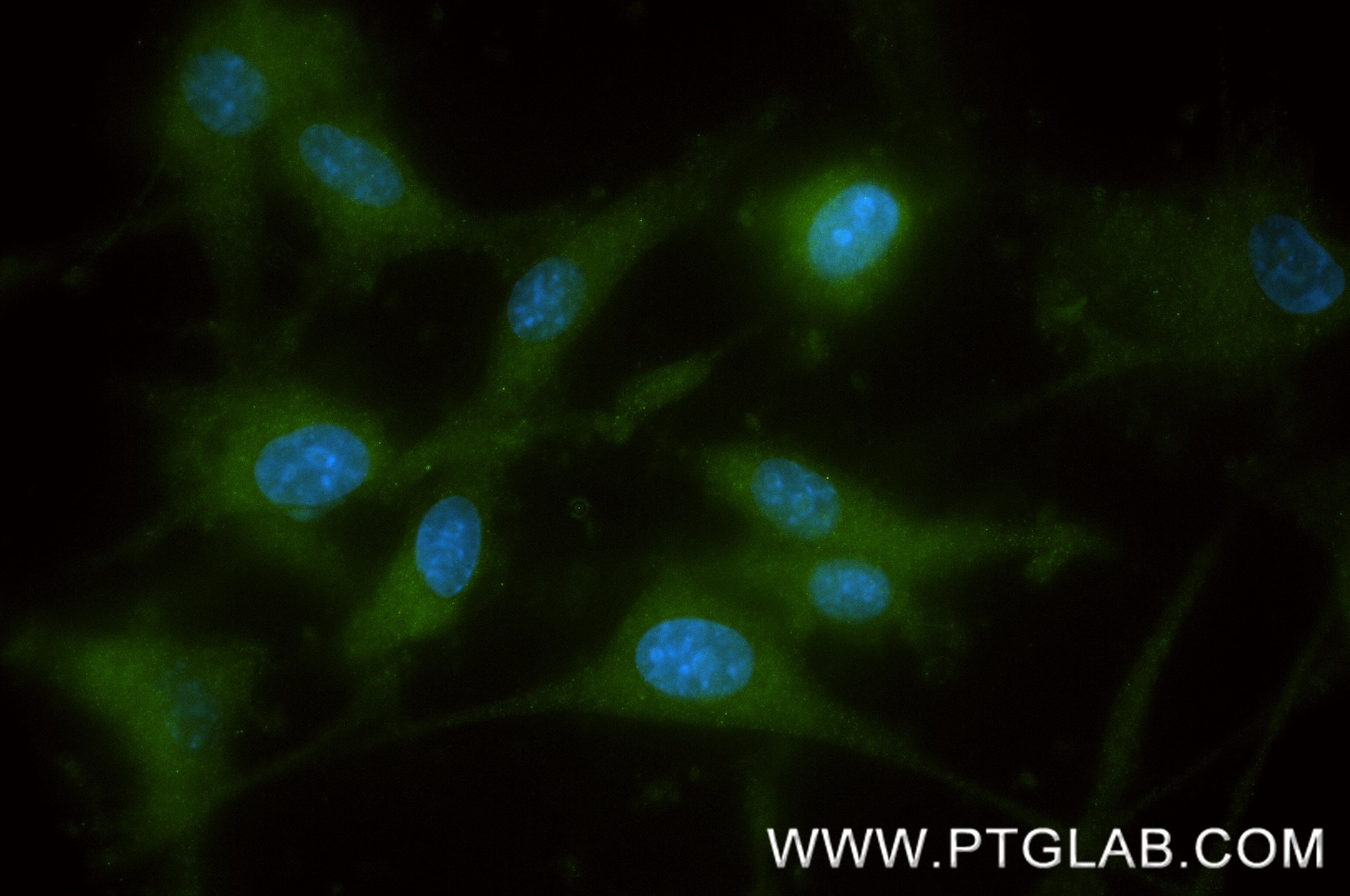 IF Staining of U-87 MG using 86846-2-RR (same clone as 86846-2-PBS) Immunofluorescence (IF) / fluorescent staining of U-87 MG cells using RGS7 Recombinant monoclonal antibody (86846-2-RR)
